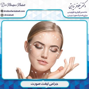 جراحی لیفت صورت