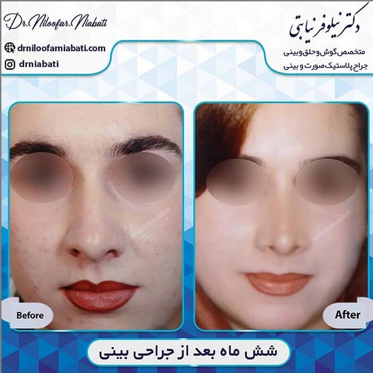 جراح بینی مازندران