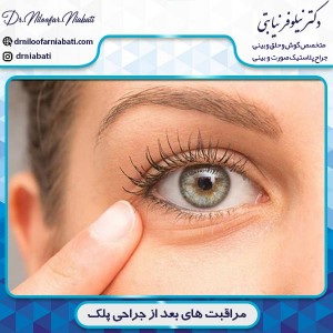 مراقبت های بعد از جراحی پلک
