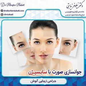 سابسیژن _ دکتر نیلوفر نیابتی