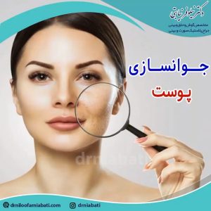 جراحی لیفت صورت