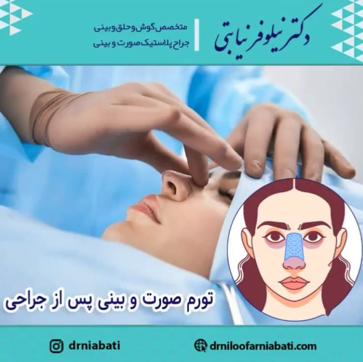 ورم بینی بعد از جراحی _ دکتر نیلوفر نیابتی
