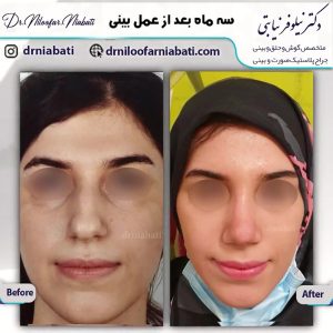 نمونه کار های جراح بینی 