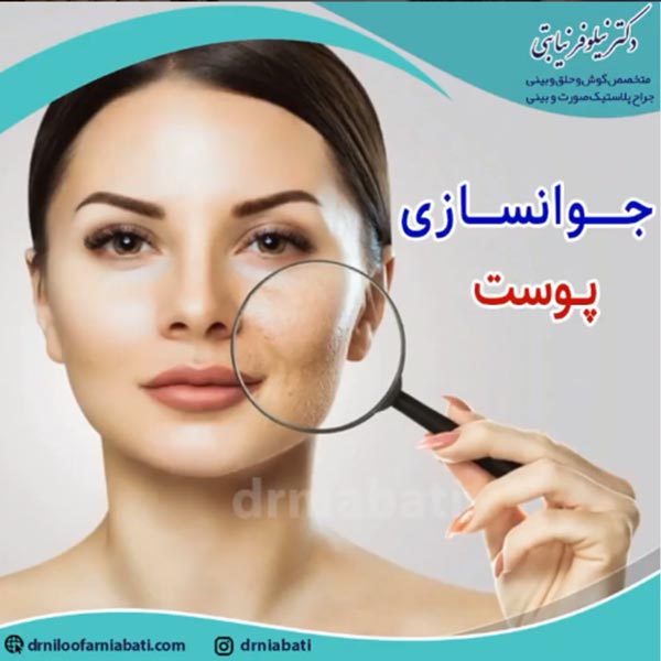 تزریق مزوبوتاکس