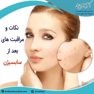سابسیژن _ دکتر نیابتی