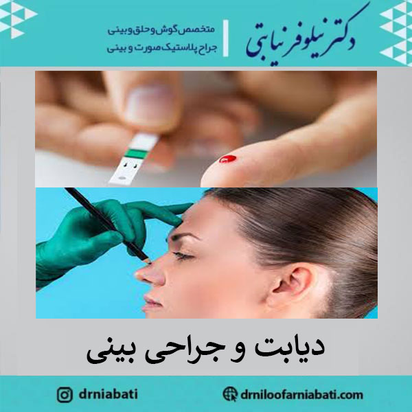 عکس دیابت و جراحی بینی | دکتر نیلوفر نیابتی