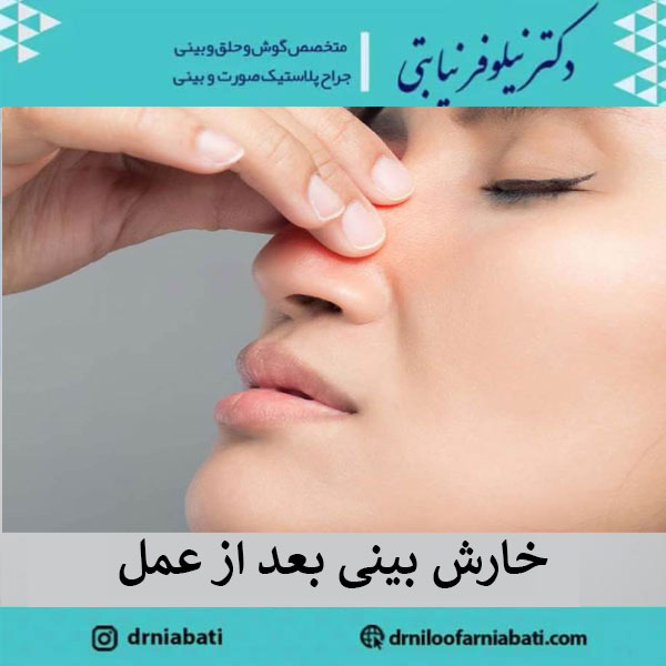 خارش بینی بعد از عمل - دکترنیلوفر نیابتی 
