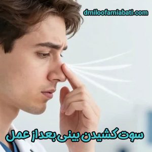 سوت کشیدن بینی بعد از عمل