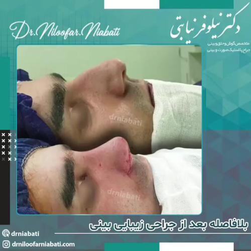 جراحی-بینی210